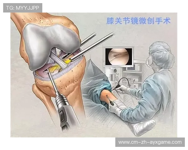 膝盖半月板微创手术后的 2026 最新康复流程图（专业版）。，膝盖半月板磨损微创手术费用